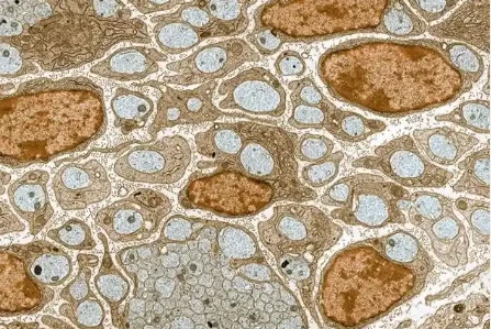 Bioglutide Adaptive Thermogenesis | Shaanxi BLOOM Tech Co., Ltd Bioglutide Adaptive Thermogenesis | Shaanxi BLOOM Tech Co., Ltd